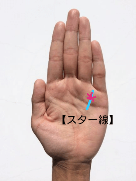 スター線